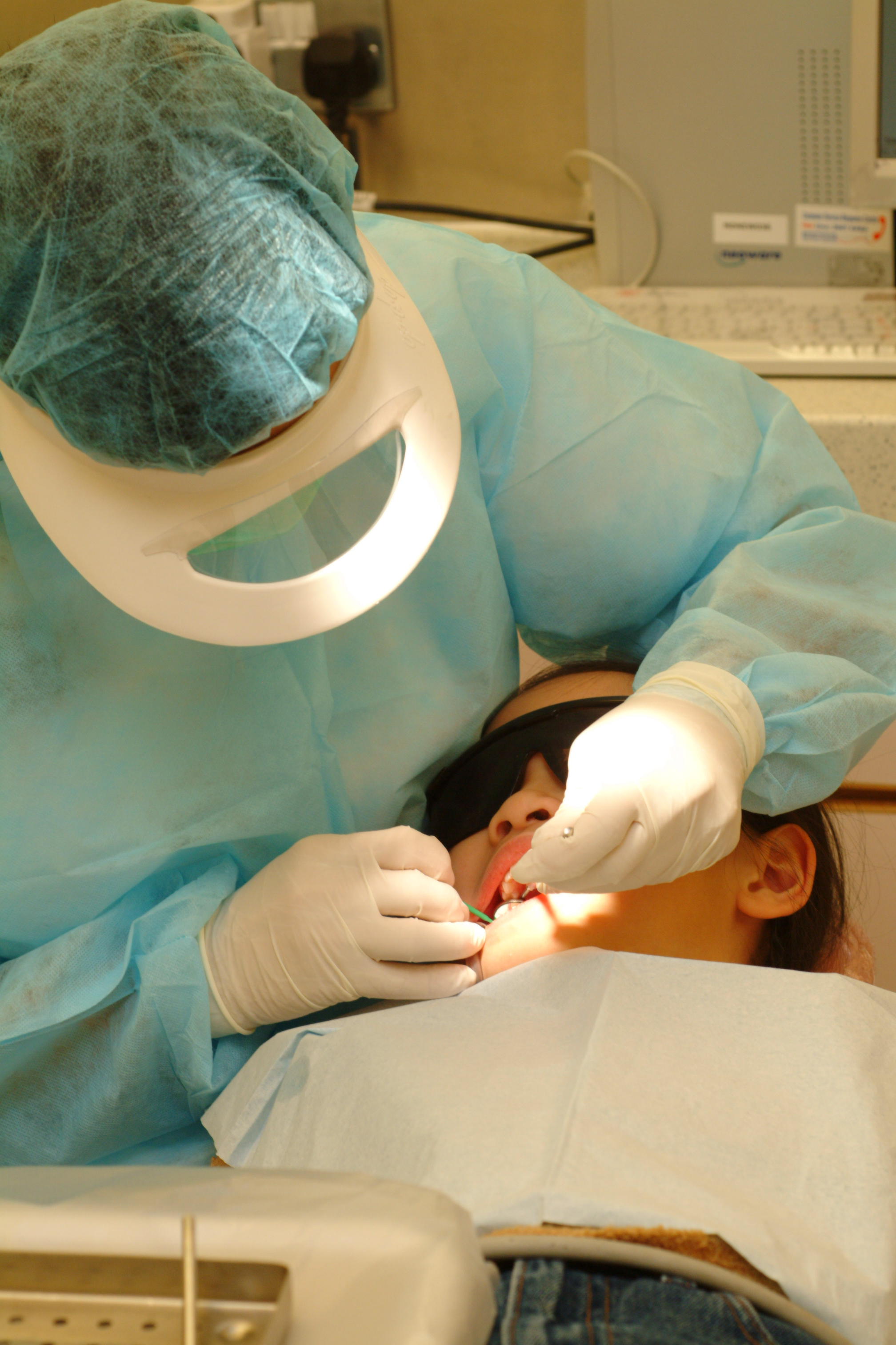 牙科医生或合资格的牙科医护人员为儿童涂上氟化氨银溶液。