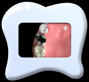 动画所见是乳齿过早脱落，导致恒齿排列不整齐。