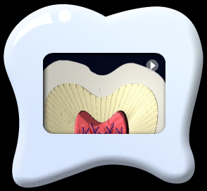Animation of athe longitudinal section of a tooth crown showing that the caries starts from enamel and then all the way to the dentine leading to pulp infection and inflammation.