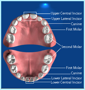 Photograph showing the position of deciduous central incisor, lateral incisor, canine, first premolar and second premolar.