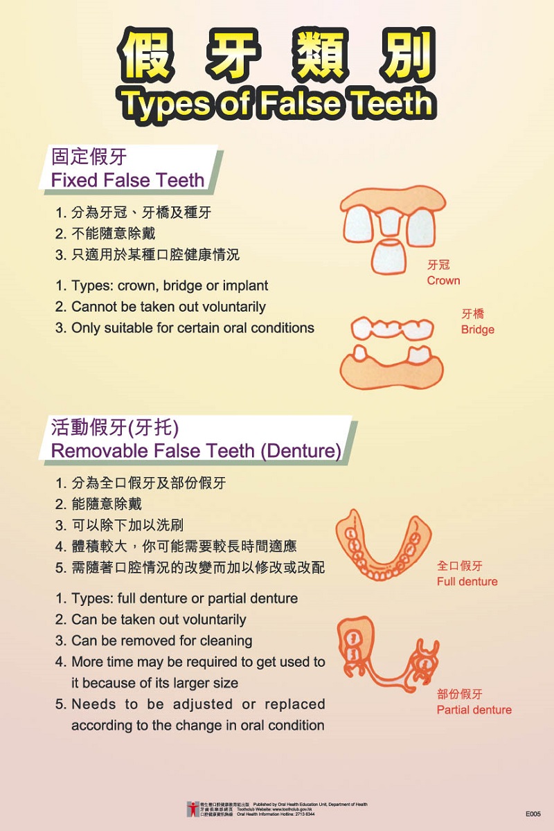 Types of False Teeth