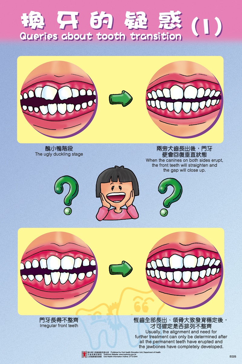 Queries about tooth transition (1)