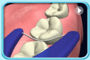 Animation continued from the previous motion showing the floss portion of the floss holder being wrapped around an adjacent tooth surface making a “C” shape in up and down motions.