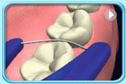 Animation continued from the previous motion showing the same floss portion moving up and downs for a few times.