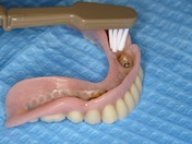 Photograph showing the cleaning of denture with a toothbrush.