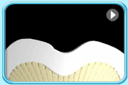 Animation of the longitudinal section of a tooth crown with the acids continuously produced by bacteria in a short period of time resulting in the continuous discolouration of enamel indicating that the mineral loss is continuous and the tooth decay spreads to dentine.
