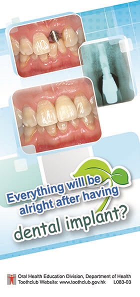 Everything will be alright after having dental implant?  (Page 1)