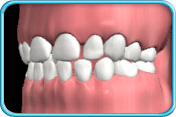 Photograph of a set of milky white deciduous teeth.