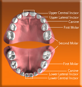 Photograph showing the position of deciduous central incisor, lateral incisor, canine, first premolar and second premolar.
