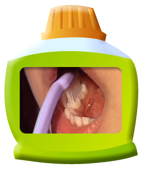 Photograph showing the chewing surfaces of molars being cleaned with a toothbrush.