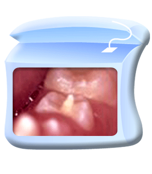 Photograph of a Leong's premolar.