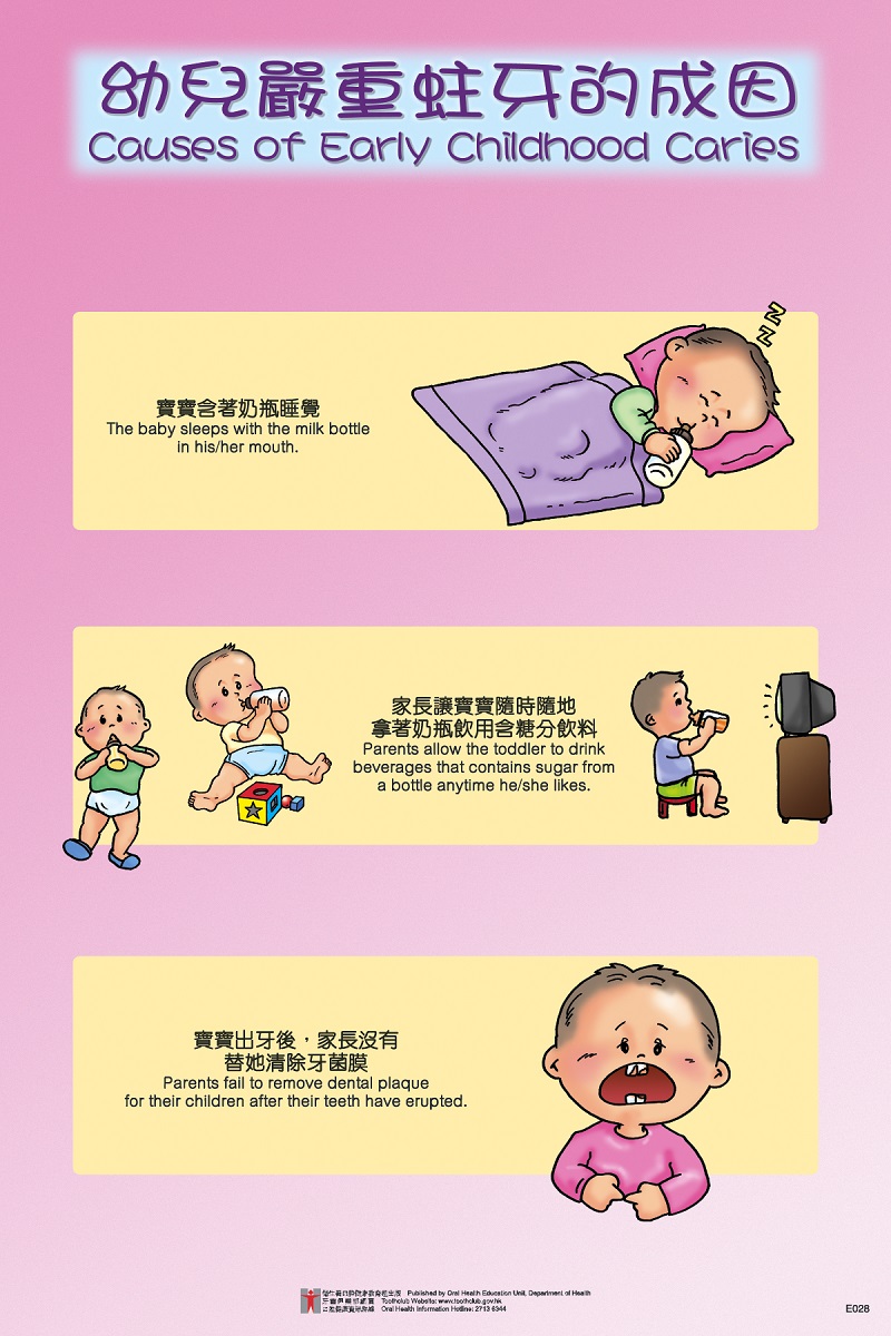 幼兒嚴重蛀牙的成因