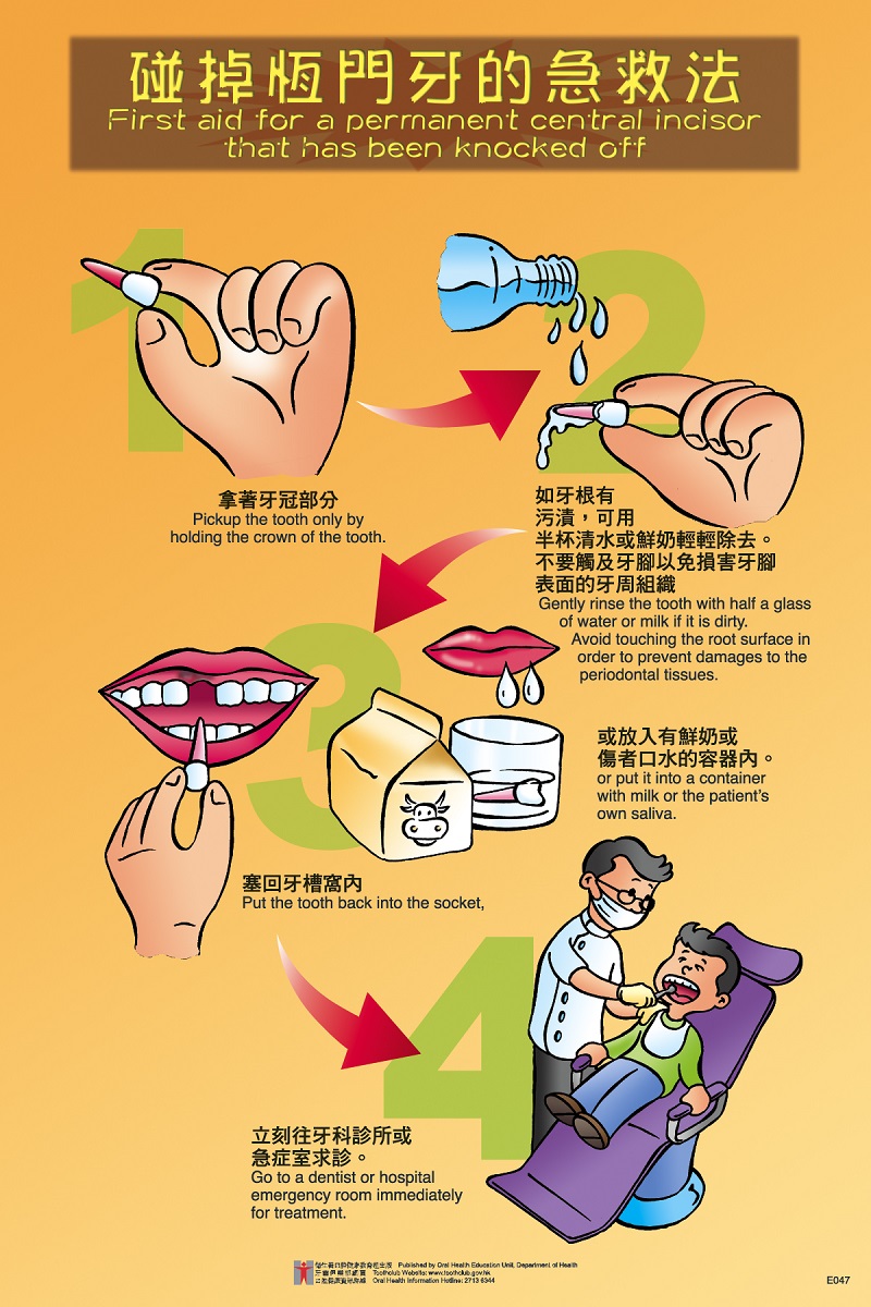 碰掉恒門牙的急救法