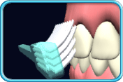 图中所见是牙龈边缘积有牙菌膜的牙齿，另有牙刷的刷毛给紧贴在牙龈边缘。
