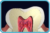 圖中所見是一顆牙齒的縱切面，可見象牙質已經外露。