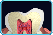 图中所见是一颗牙齿的纵切面，可见象牙质已经外露。