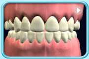 動畫片段所見是上下排牙齒磨牙的情況。