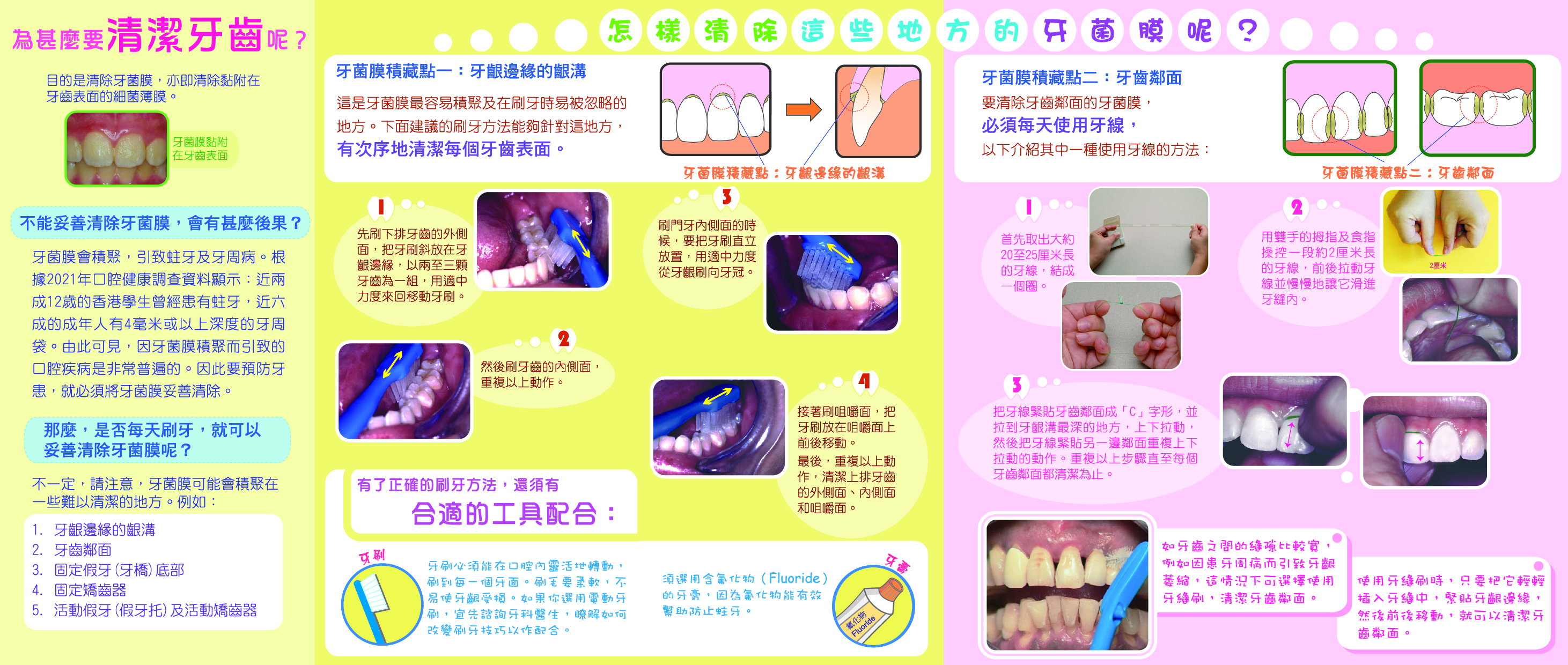 清潔牙齒點只刷牙咁簡單？（第二頁）