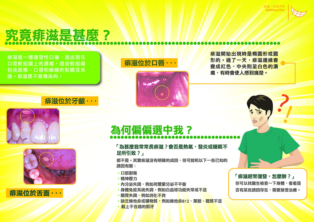 痱滋 非知不可（第二頁）