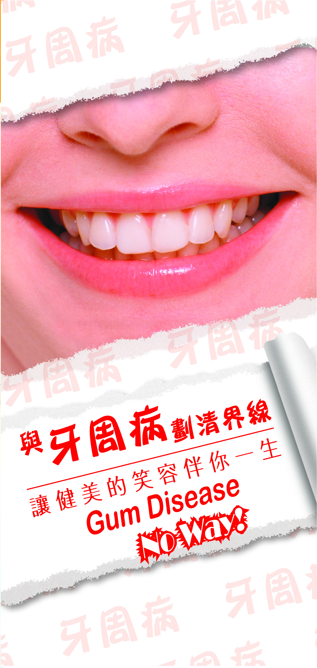 與牙周病劃清界線（第一頁）