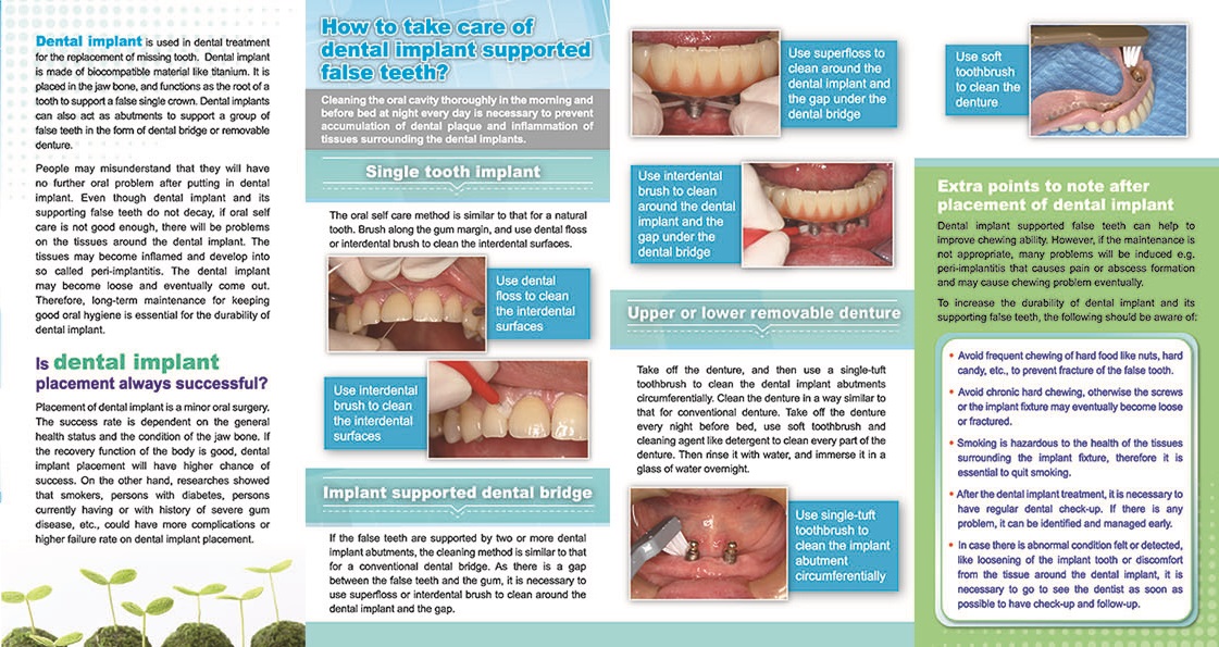 Everything will be alright after having dental implant?  (Page 2)